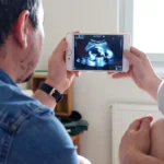 Un couple observe la photo d’une échographie annonçant l’arrivée d’un bébé